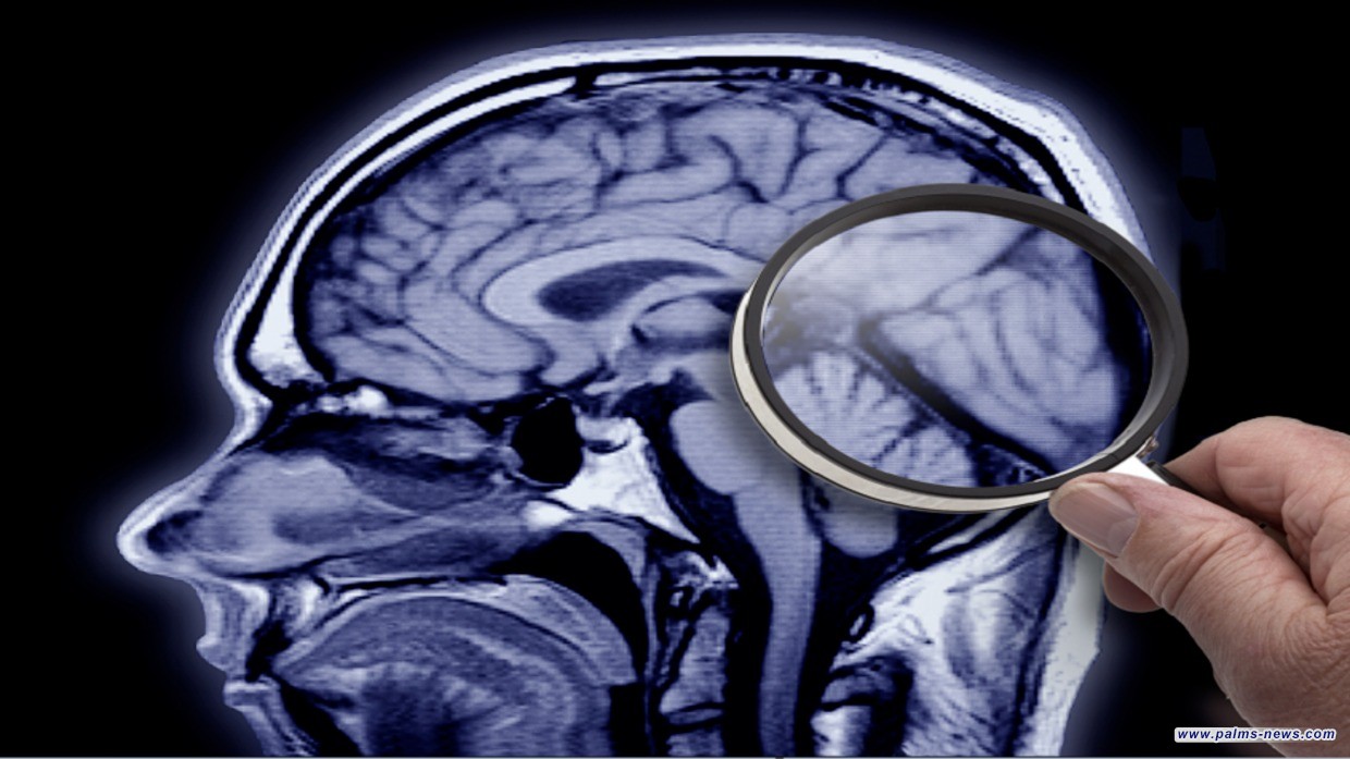 اكتشاف رائد قد يحمل مفتاح علاج ألزهايمر قبل عقود من ظهور الأعراض